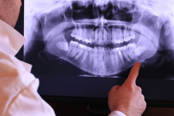 Best Emergency TMJ Treatment in Shenorock, NY