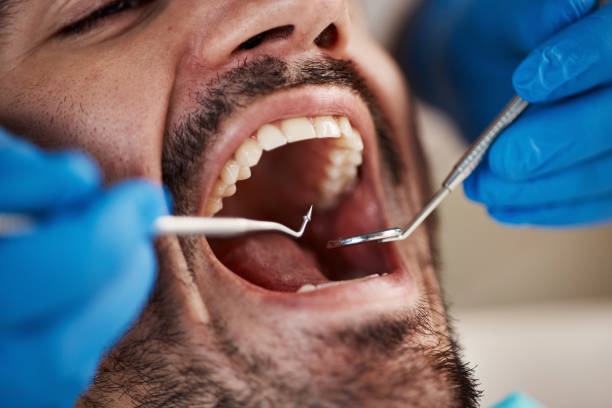 Best Emergency Treatment for Dental Infections or Abscesses in Shenorock, NY
